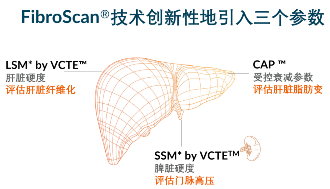 喜訊！FDA擴大了FibroScan?在肝臟綜合管理中的應(yīng)用范圍